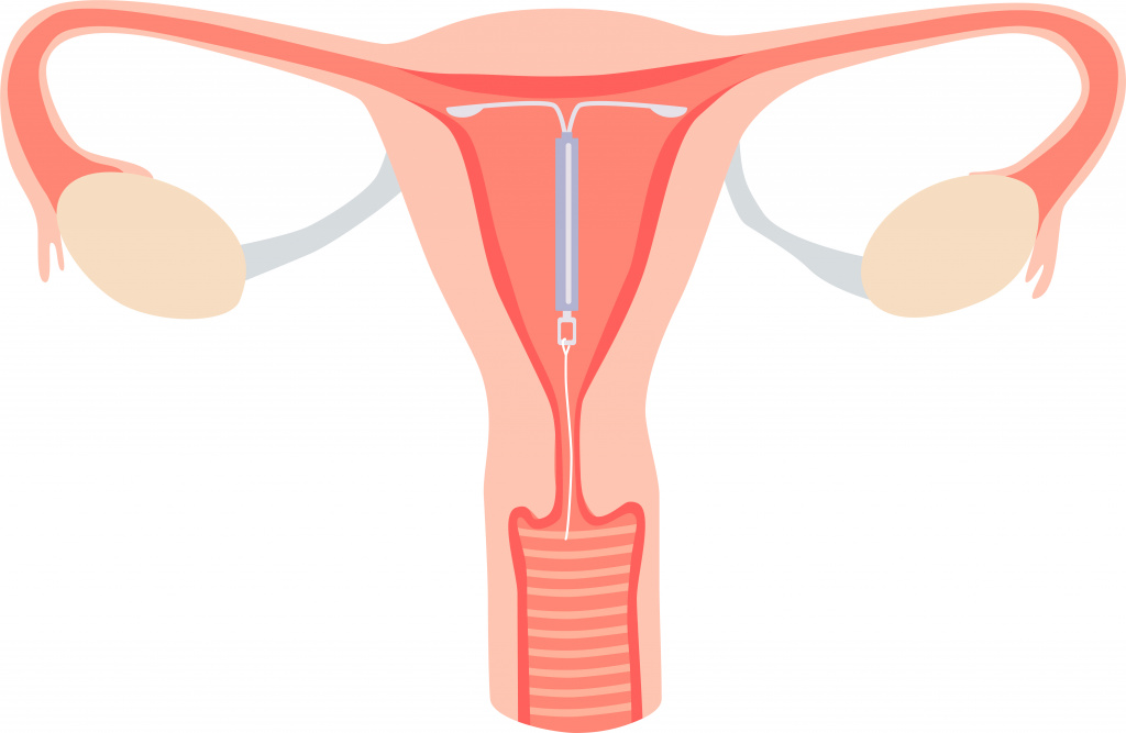 ВМС схематично