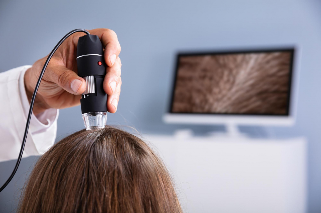 трихоскопия