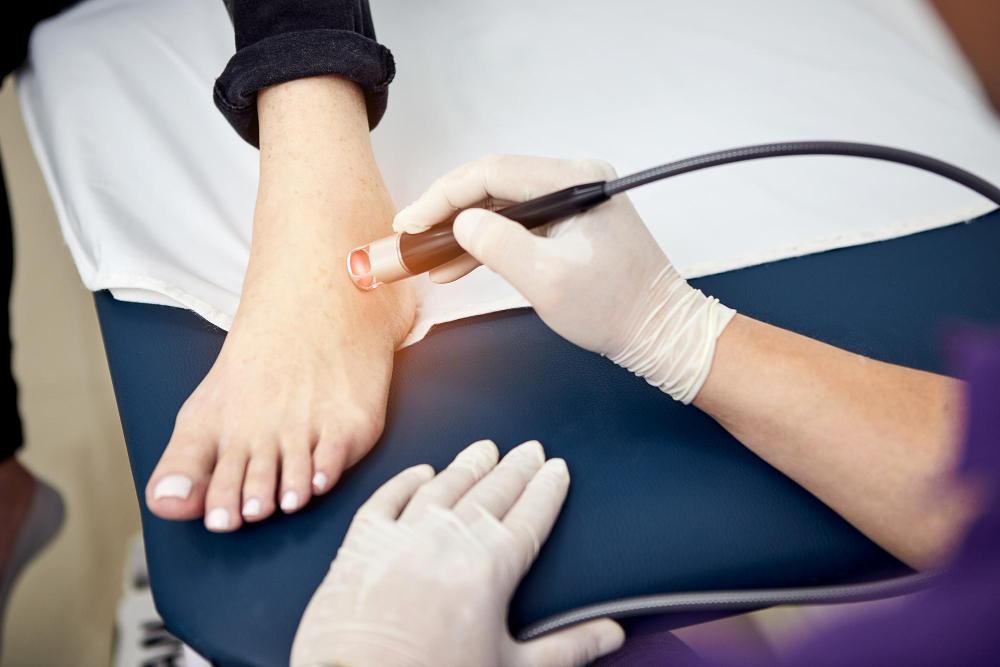 Удаление лазером