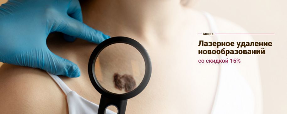 Cкидка 15%: лазерное удаление любых новообразований