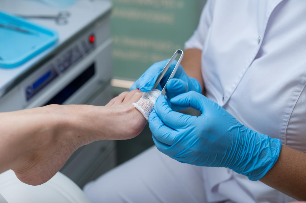 Лечение вросшего ногтя